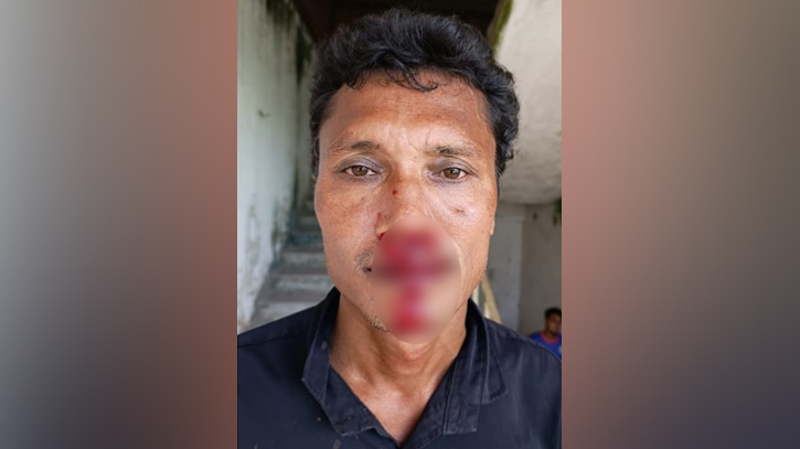 সোনারগাঁয়ে সীমানা প্রাচীর বিরোধে হামলা, নারীসহ আহত ৩
