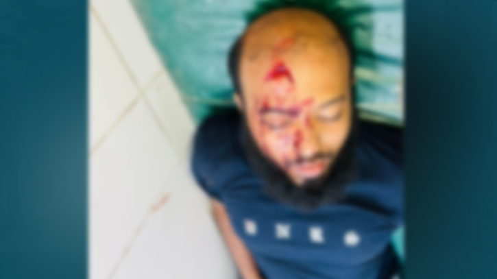 বন্দরে ইসলামী আন্দোলনের নেতার উপর হামলা