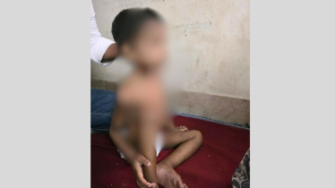 কাশিপুরে ৪ বছরের শিশুকে নির্যাতন, তালা ভেঙে উদ্ধার করল পুলিশ