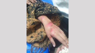 বন্দরে যৌতুকের দাবিতে সাংবাদিক কন্যাকে কুপিয়ে জখম, শাশুড়ি আটক