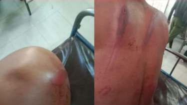 গিয়াসের ২ ছেলে-সহযোগীদের বিরুদ্ধে মান্নান সমর্থকদের হামলার অভিযোগ