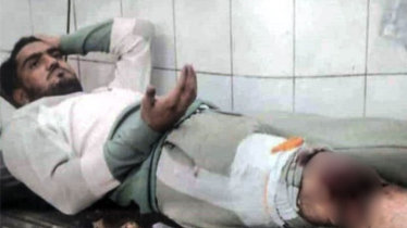 সিদ্ধিরগঞ্জে চাঁদা না দেওয়ায় ব্যবসায়ীকে কুপিয়ে জখম