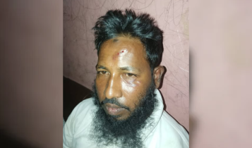 ফতুল্লায় জামায়াত নেতার উপর হামলার অভিযোগ